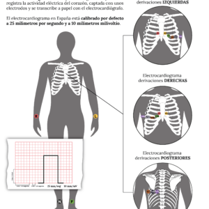 infografia_como_hacer_un_electrocardiograma_correctamente